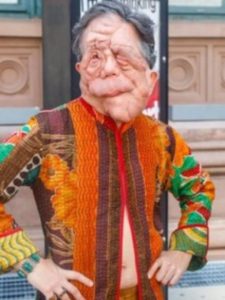 A Different Man 2024 Adam Pearson Coat.